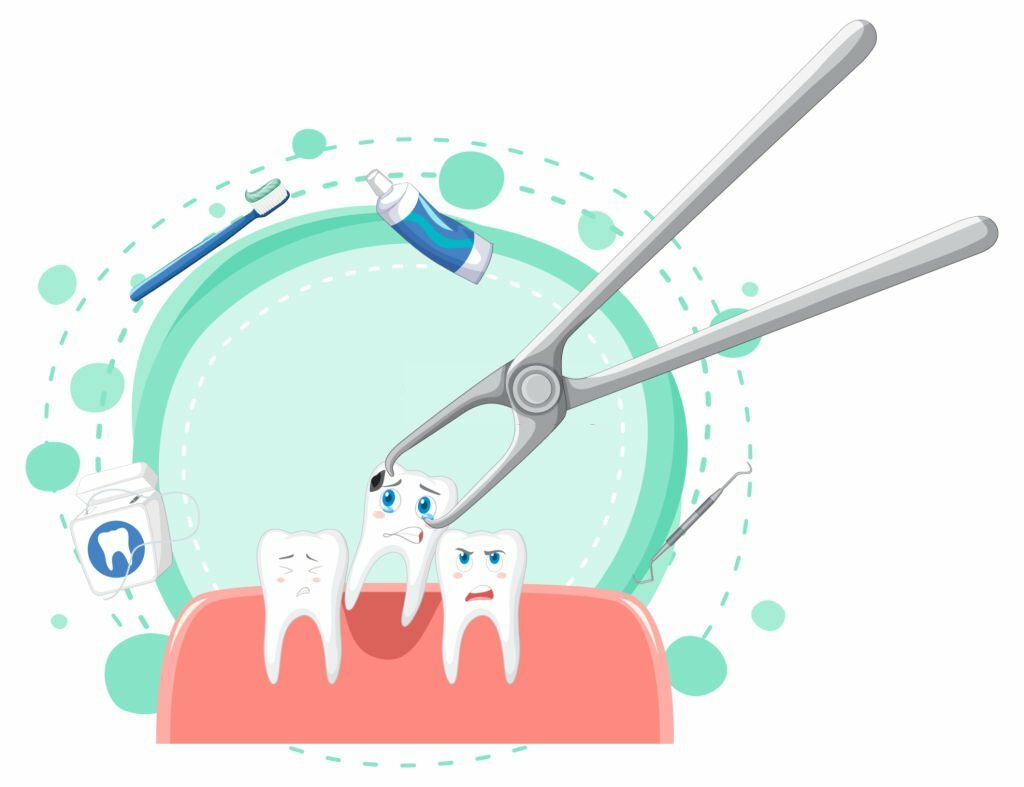 Tooth Extraction In San Antonio, TX: A Comprehensive Guide_1