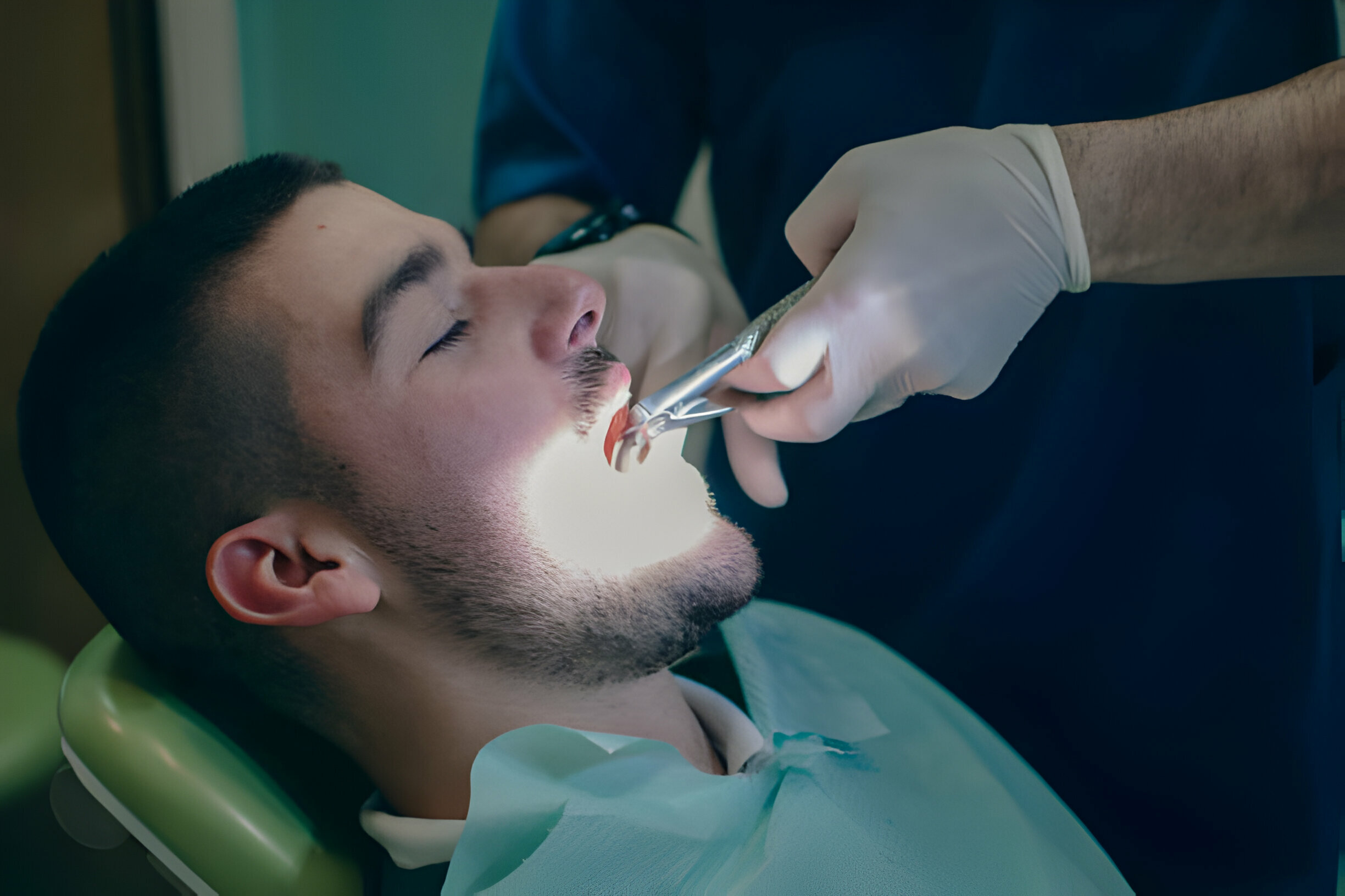 Tooth Extraction In San Antonio: A Comprehensive Guide_1