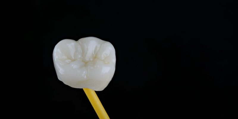 Choosing the Right Dental Crown: A Complete Guide by Heritage Dental in San Antonio, TX_FI