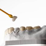 Same-Day Dental Crowns in San Antonio TX Heritage Dental’s CEREC Technology