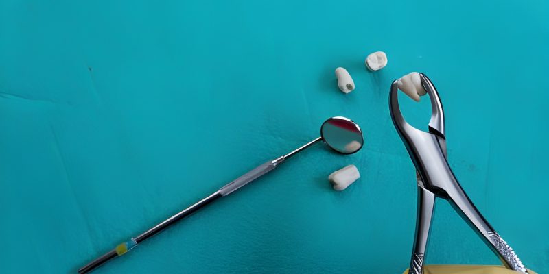 Nutrition for Faster Recovery: Best Foods and Foods to Avoid After Tooth Extraction in San Antonio_FI