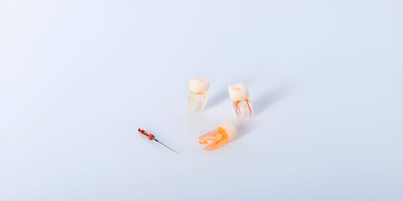 A Step-by-Step Guide to Root Canal Treatment at Heritage Family Dentistry_FI