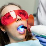 Before and after professional teeth whitening treatment by a dentist in San Antonio TX